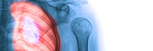 featured allergy article